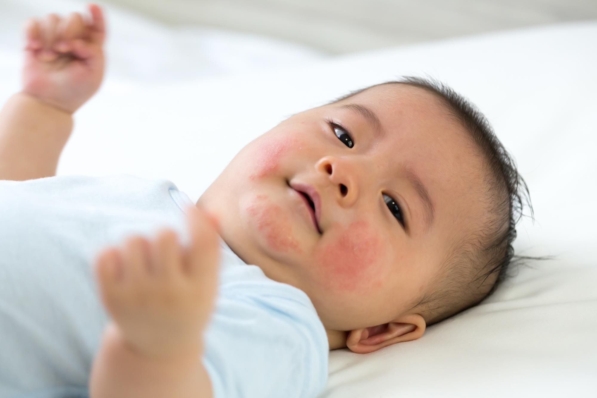 telur puyuh untuk MPASI, manfaat telur puyuh, MPASI bayi 6 bulan, makanan sehat bayi, Bunda, si Kecil